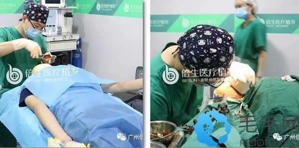 广州倍生植发手术之麻醉过程