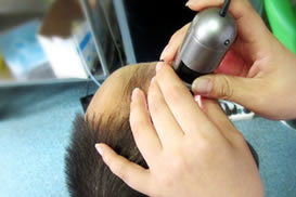 宁波美莱植发中心毛囊检测室