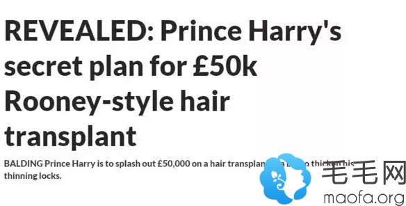 英国媒体爆料哈里王子花费45万植发