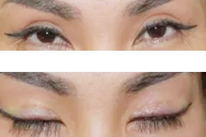 三张图片让你秒懂哈尔滨美佳娜睫毛种植的效果和过程