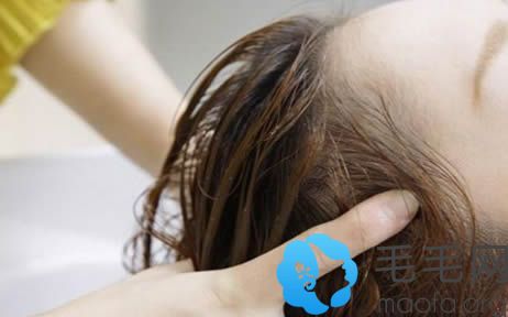女性洗头掉头发怎么办？5大方法轻松让你缓解掉发的困扰