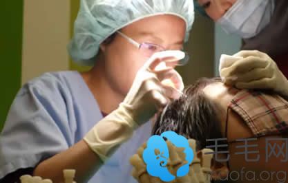 林宜蓉医生正在进行植发手术