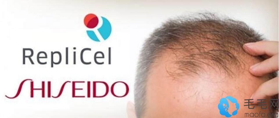 资生堂和RepliCel联手共创RCH-01克隆技术能治愈雄脱的生发技术