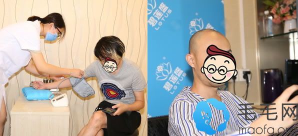 在上海碧莲盛做头顶加密植发手术归来,效果和过程分享出来