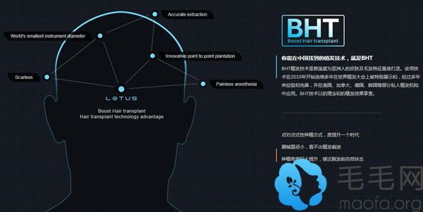 BHT2.0多维高密植发技术