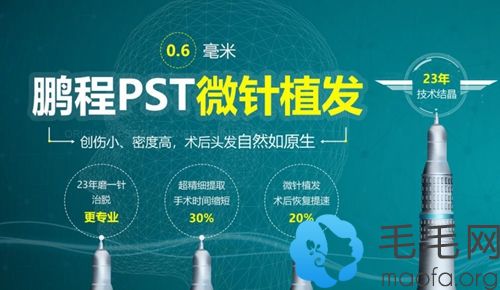 深圳鹏程PST微针植发技术