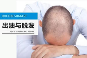 北京碧莲盛植发医生尹梓贻讲述为什么头发一油就容易掉发