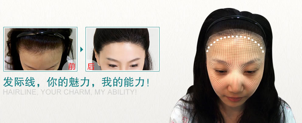 来西安科学毛发医院，用发际线调整来实现你的v脸梦