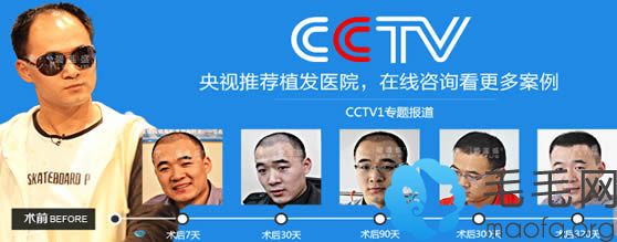 碧莲盛是央视CCTV上榜医院