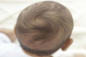 宝宝脱发误区：宝宝脱发造成的“枕秃”是因为缺钙？