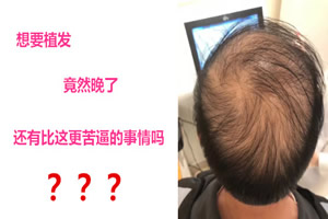 号外：南京新生植发医生竟然拒绝为脱发患者植发