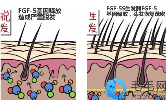 乐喜力丝育发液含有“FGF-5S生发酶