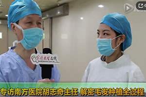直播广州南方医院胡志奇毛发移植全过程及植发后注意事项