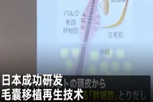 脱发福音!日本毛囊移植再生技术于2018年在小白鼠上实验成功