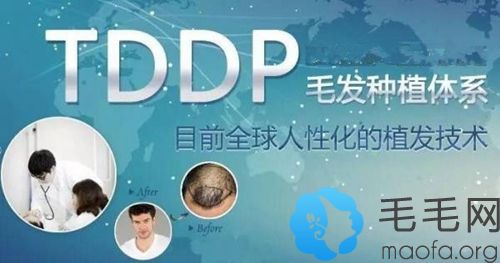 TDDP毛发种植技术原理