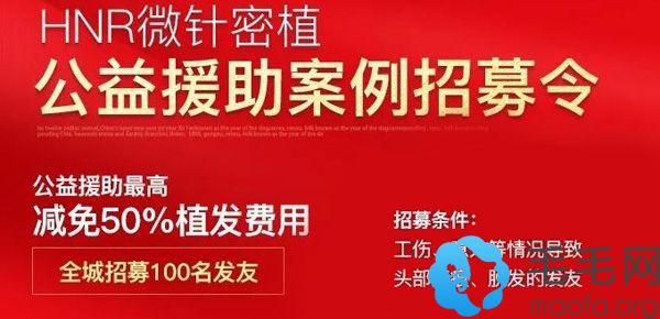广州曙光植发科并面向全城招募100名公益援助案例